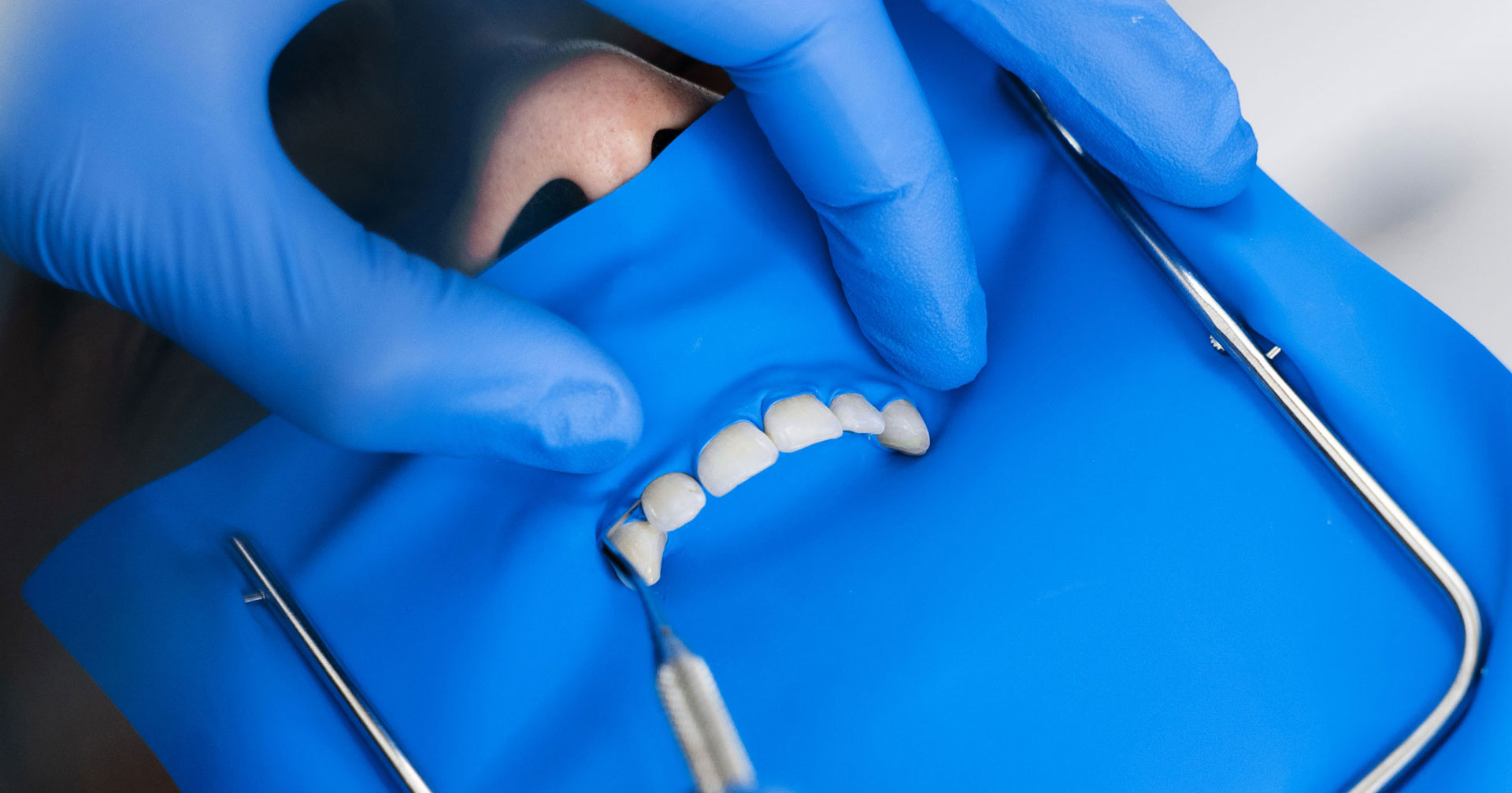 Restoratif Diş Tedavisi ve Endodonti